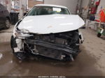 2015 Volkswagen Jetta 2.0l Tdi S Белый vin: 3VW3A7AJ5FM316670